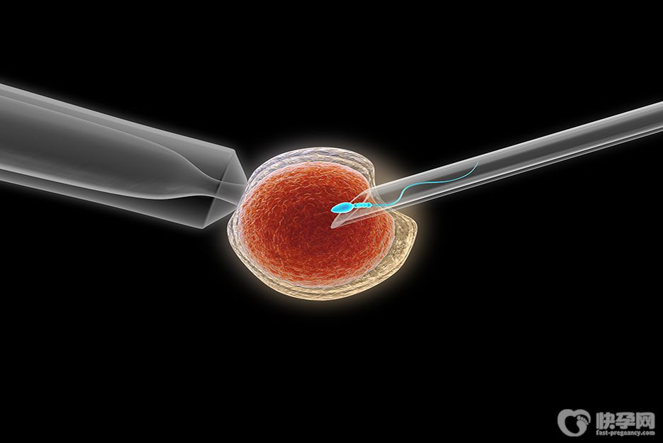 单身可以在哪里做试管婴儿手术，这3个国家可供选择