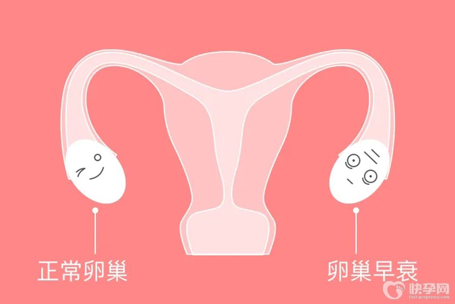 31岁卵巢早衰做试管能成功吗？记住这两点，助你圆上父母梦