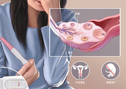 50岁绝经还能做试管婴儿吗？供卵也许是最后一根稻草