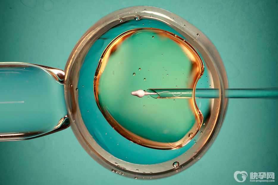 速看！弓形子宫做试管婴儿能成功吗？受孕率与正常人相差无几