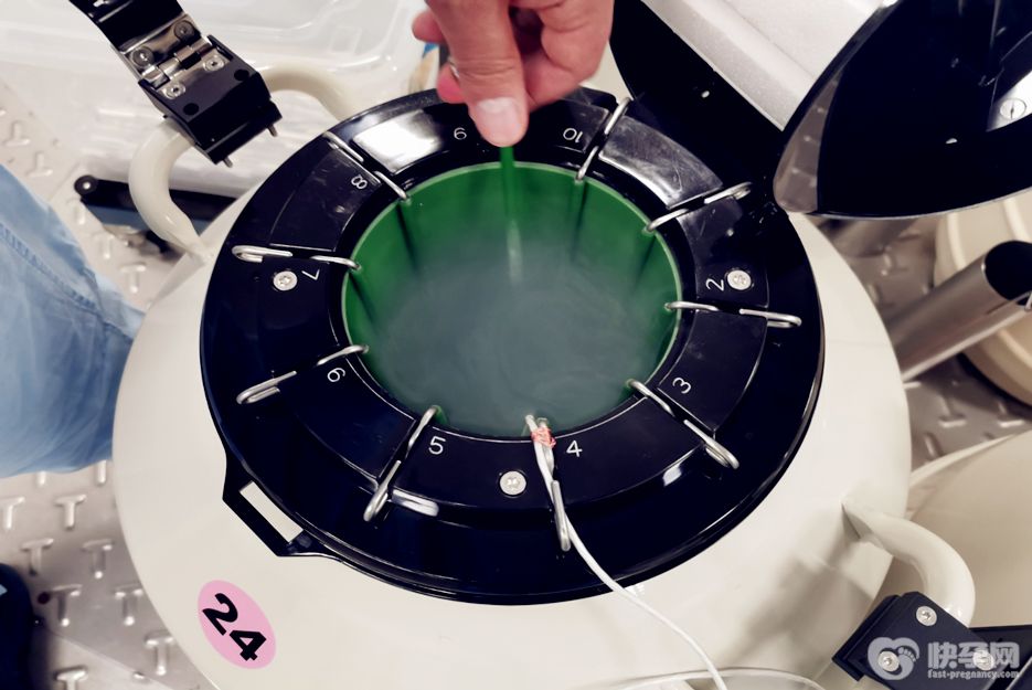 2025长沙做试管供卵生男孩费用揭晓-附供卵生男孩前提条件