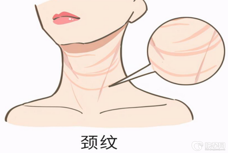 治疗颈纹最有效的方法，这4种方法或能还你天鹅颈