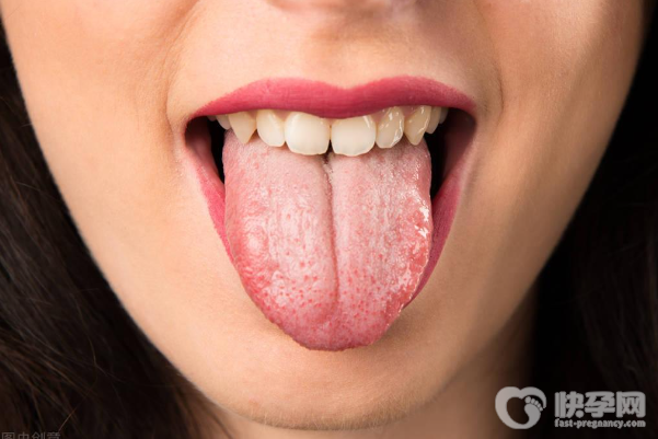 湿气重的人都有这7个症状表现，希望你一个也没有