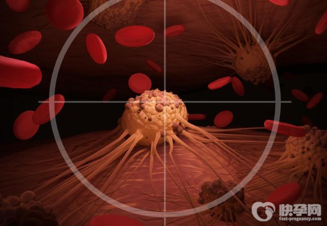 脖子淋巴癌早期症状图片，这4个症状就是它的早期信号