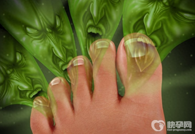 除脚臭的10个小方法，总有一个适合你