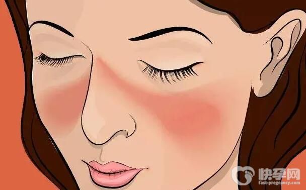 红斑狼疮能怀健康宝宝吗？做三代试管要多少钱？