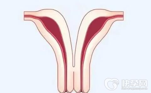纵隔子宫试管怀孕了能正常生下孩子吗？