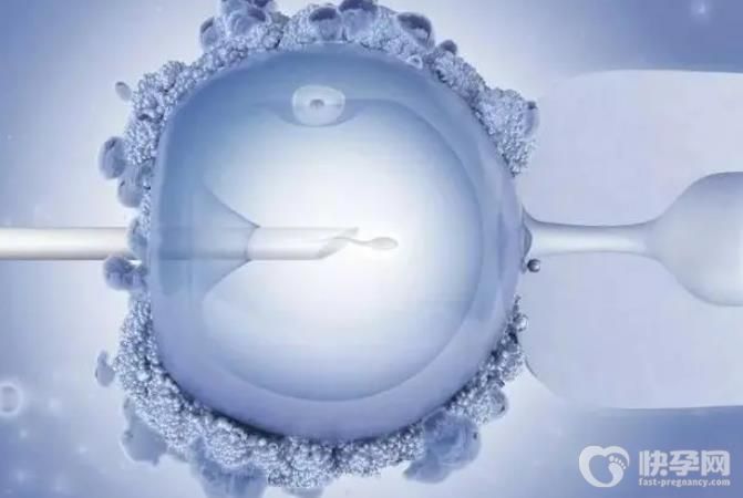 中山市借卵生子试管机构名单汇总附2025年各院卵源等待时长！