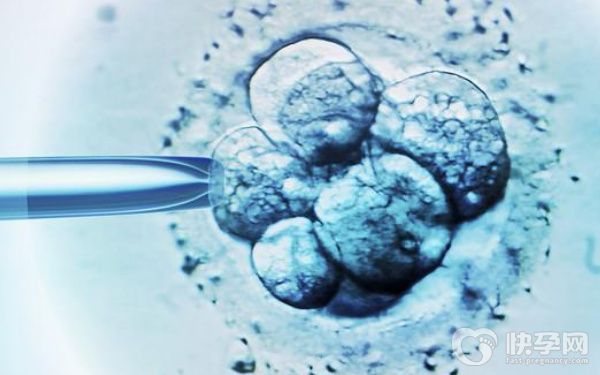 贫困户做试管婴儿除了申请补贴还有什么优惠政策？