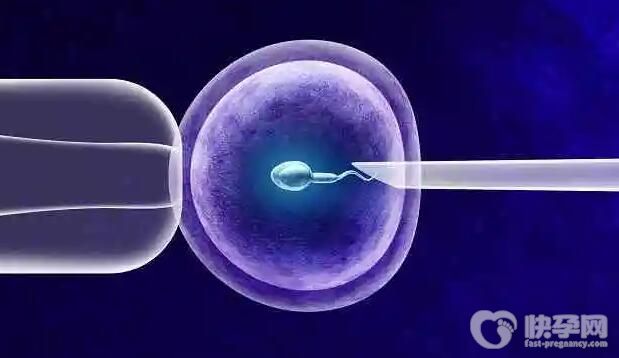 几代试管可以分男女性别吗？成功率费用多少？