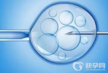 2024连云港试管男孩医院排名费用多少？