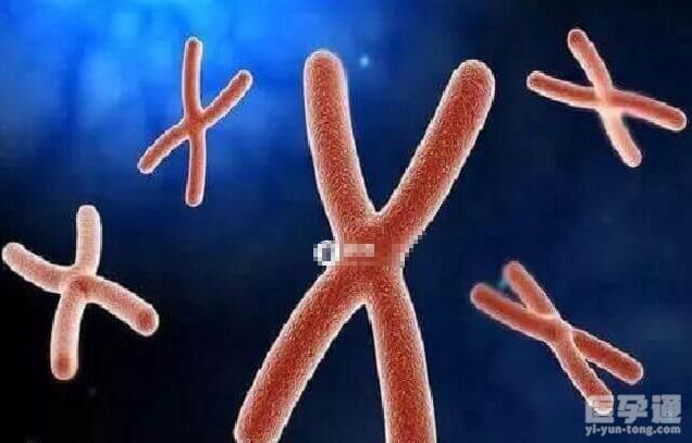 10号染色体异常生孩子不死也畸形，3大表现早了解早干预！
