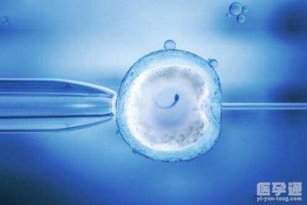 男同性恋可以做试管婴儿吗？应该怎么做？