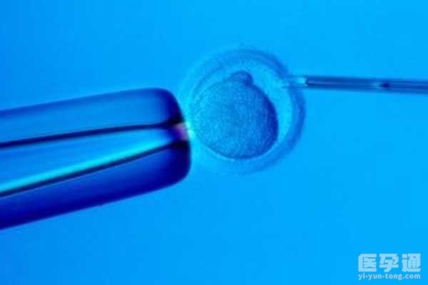 为何中国单身不能接受试管婴儿？是因为法律不允许吗？