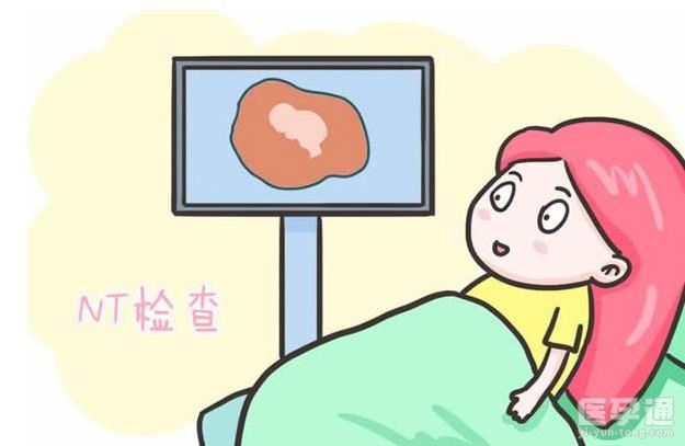 nt单子上有男女标志，真的吗？不要被传言误导了！