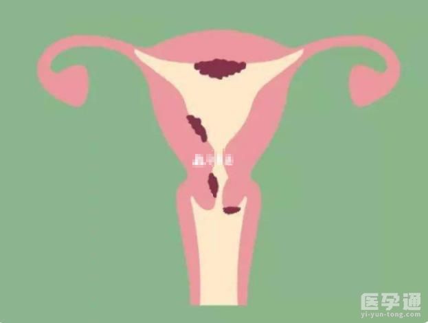 53岁没绝经有可能自怀，这四大影响生育因素要知晓！