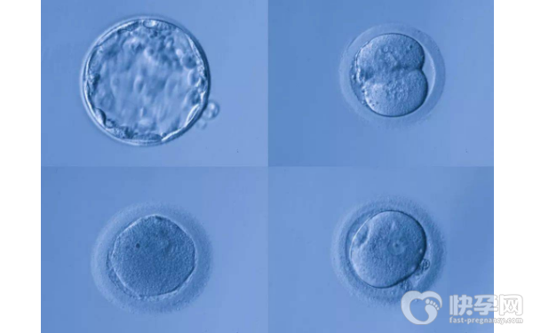 海南桂平做试管婴儿要多少钱？