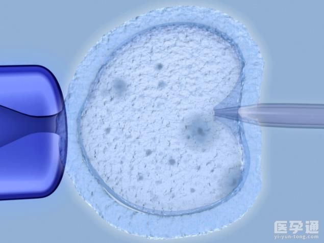 去泰国做试管婴儿可以选性别吗？操作流程是怎样的？