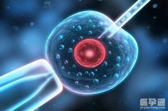 去马来西亚做试管婴儿可以选择胎儿的性别吗？选择性别的原理是什么？