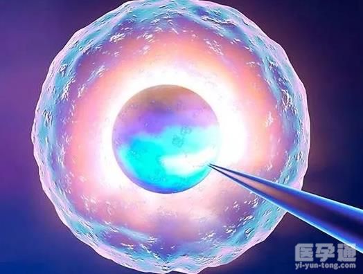 女方有蚕豆病做试管婴儿能选择性别，避免基因遗传是主要原因！