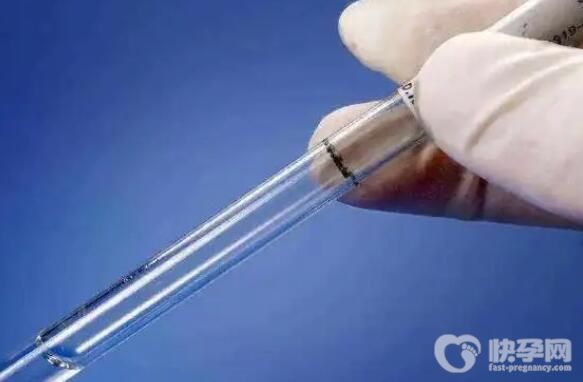 2024浙江最有名试管医院男孩费用多少钱？