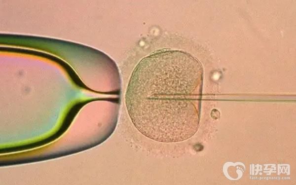 2023第三代试管选男孩多少费用？大约在8-10万元