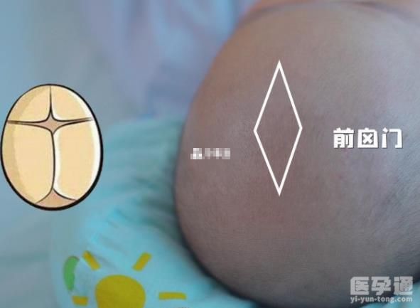 0至2岁小儿囟门对照表分享，大小是否正常一比就知道！