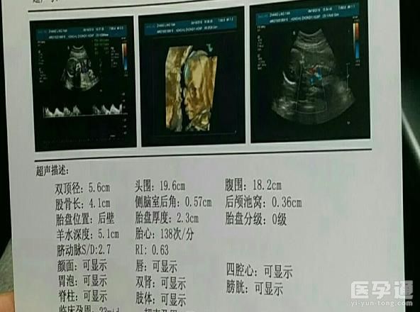 NT哪三个亮点能看出来是男孩女孩？