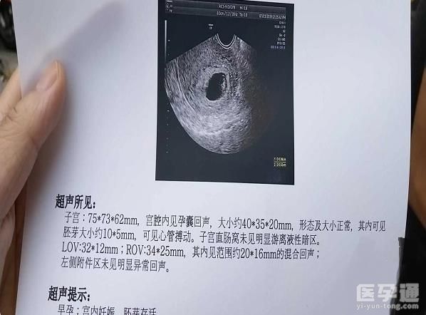 2024云南产假158天怎么算看这，新政策里还有男方培育假！