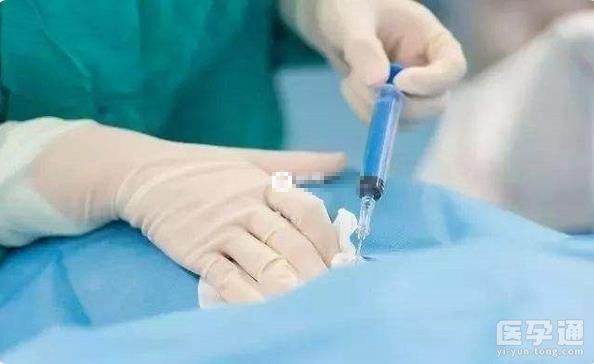 羊水穿刺检查结果有一项不合格是不是就不能继续生育了？