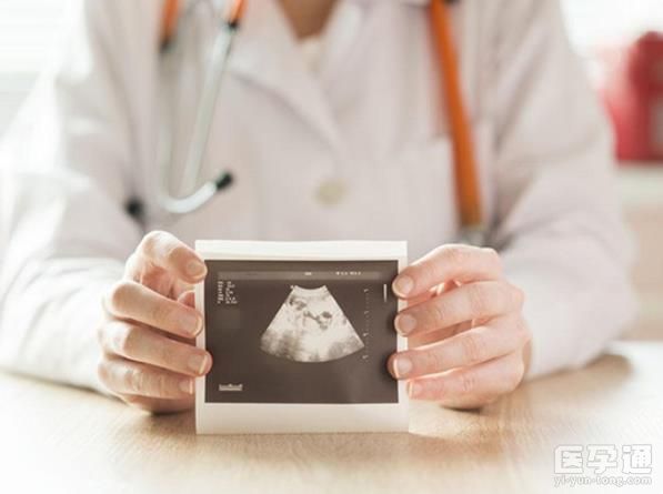 nt图弯着就是男孩！这些nt看男女诀窍建议收藏！