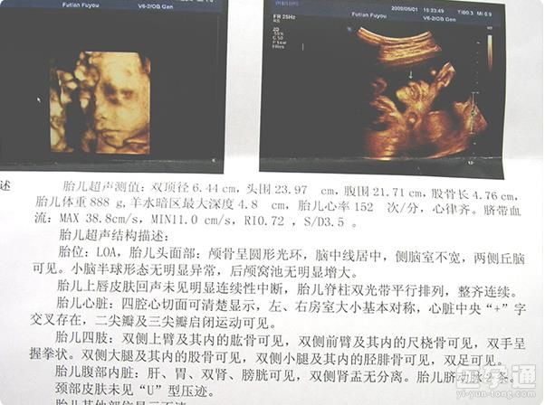 大排畸单子上有这个标志就是男孩，别傻傻地算双顶径了！