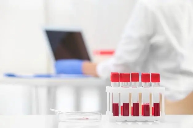 试管婴儿开始之前做的血液检查都有什么作用？是关于什么的？