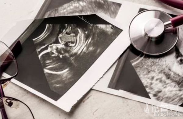 重庆妇幼保健院第二代试管婴儿两次失败 我该怎么办？