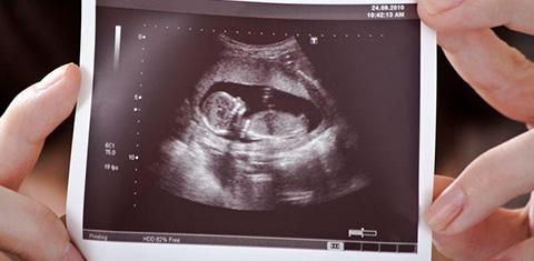 2022泰国试管婴儿攻略索引：A卵B怀，精子库供精入境难