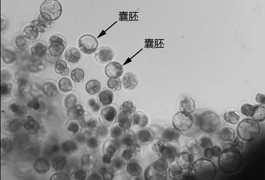 北医三院养囊几天短信通知？听听做试管姐妹怎么说