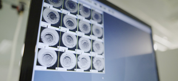 北医三院养囊技术怎么样？优胚个数决定养囊成功率