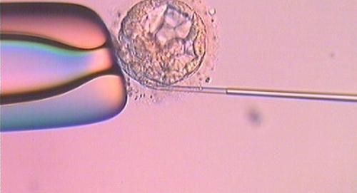 备孕期间卵泡萎缩不要怕 从引起原因找治疗方法