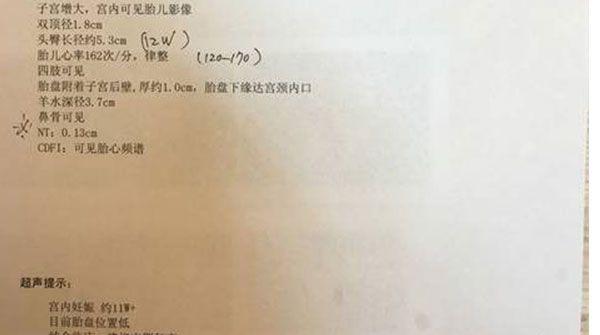 胎儿的去留应谨慎，nt值为4.1mm时无创也可通过