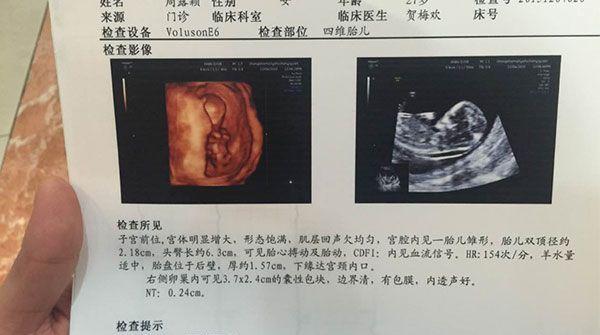 nt厚度值为3.5mm虽严重，但后续检查依然要做