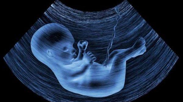 nt值为3.8mm时不一定是唐氏儿，宝宝是否畸形还需做无创