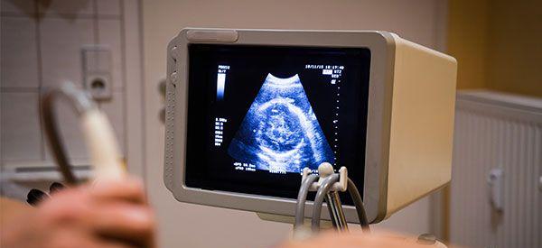 nt检查值为正常的2.2mm还需要做羊水穿刺吗？