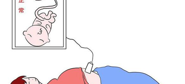 22+3周医生安排大排畸会太早吗？