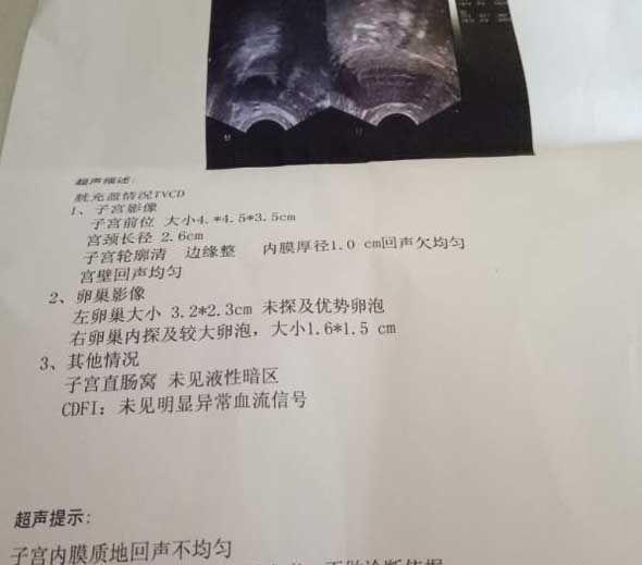 内膜回声不均匀别担心，来听听李湘元医生怎么说？