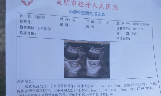 B超别查太早！试管移植第22天有这些症状得注意了