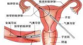 不孕不育夫妇想做试管婴儿该做哪些检查？12项检查缺一不可