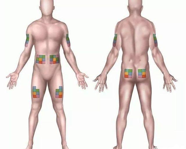 试管婴儿保胎小贴士，自己注射低分子肝素应该注意哪些问题？