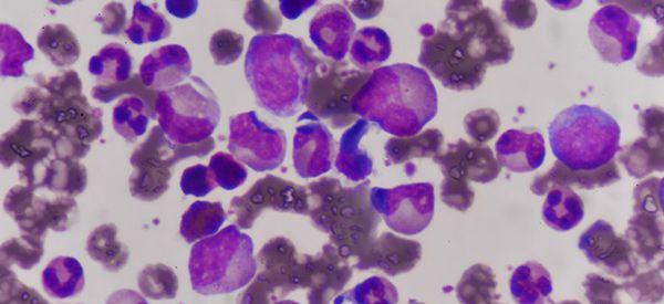 生精细胞减少导致无精，请问是否还能恢复？