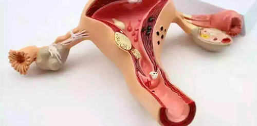 宫颈糜烂做试管婴儿需要先治疗?来听听医生怎么说