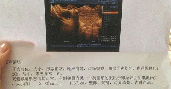 最快10天取卵！黄体期促排需要多长时间看这个指标